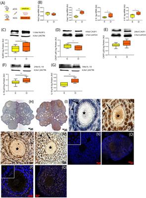 Leptin Signaling in the Ovary of Diet-Induced Obese Mice Regulates Activation of NOD-Like Receptor Protein 3 Inflammasome